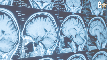 Una querida estrella de telerrealidad actualiza a sus fans tras su tercera cirugía cerebral